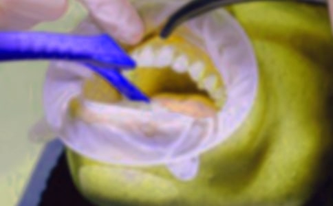 ����ѡ������������300��3ƪ