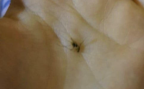 被蚊子咬的幽默句子