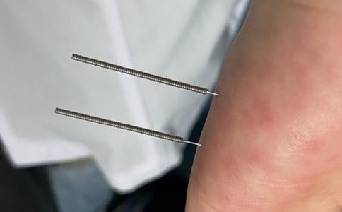 ɽ�����ר������ʲô