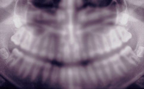 ���ǳݵĽ���˵˵10ƪ